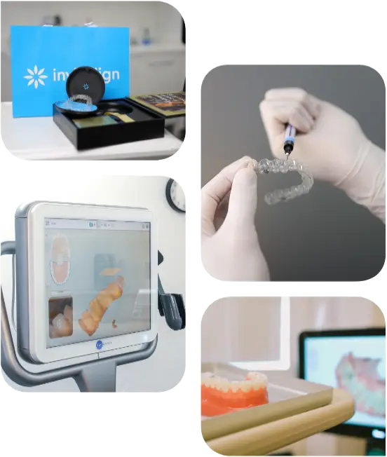 Invisalign treatment process and dental scanning